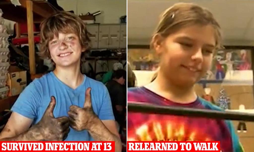 Swimmer who contracted brain-eating amoeba from lake dies… as experts worry of&nbsp;spread