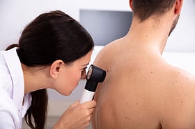 Nicotinamide Lowers Skin Cancer Risk in&nbsp;Patients