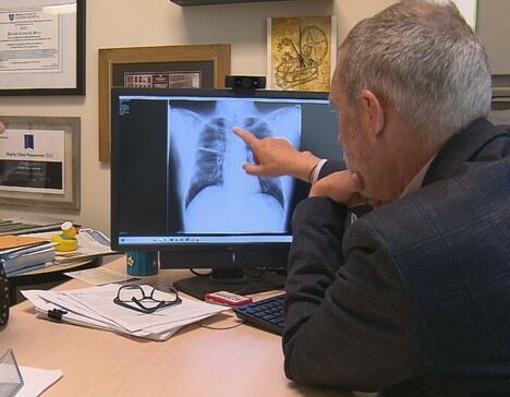 Lung Cancer Pioneer Fights Stage 4 to Light the&nbsp;Way