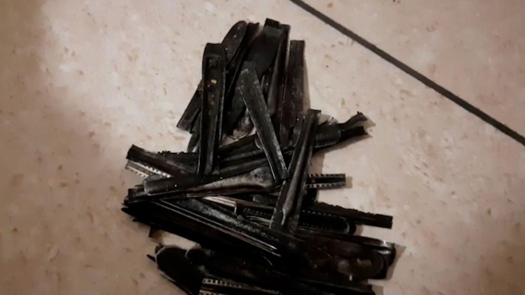 Surgeons Remove 29 Spoons, 19 Toothbrushes, and Pens From Patient’s&nbsp;Stomach