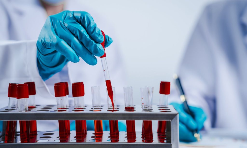 The 4 Essential Blood Tests for Everyone Over 40, Says a&nbsp;GP